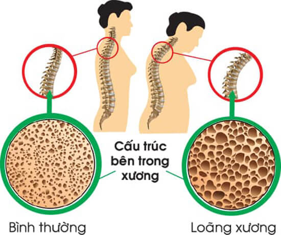 vien uong bo sung canxi d3 kirkland calcium 600mg 500 vien anh 1